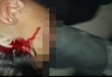 Pembacokan di Warung Peteuy Garut, Korban Kritis Pelaku Diburu Polisi